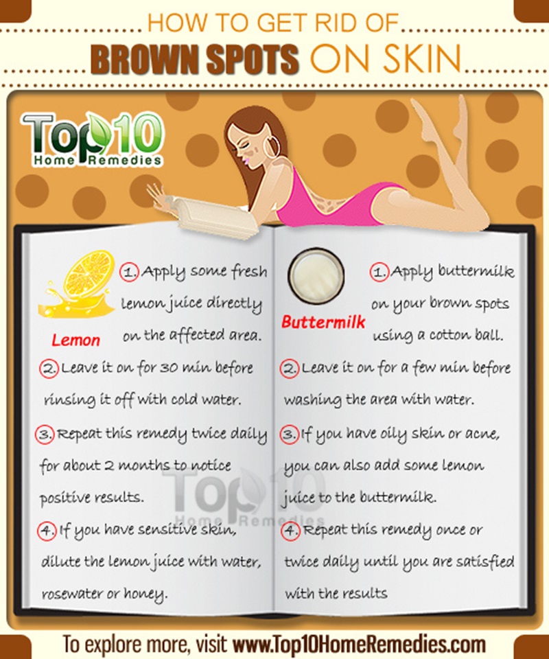 How to Get Rid of Dark Spots Using Natural Home Treatments