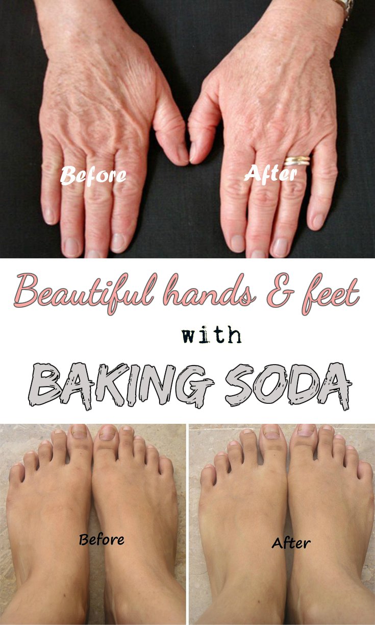 How to Have Beautiful Hands and Feet with Baking Soda