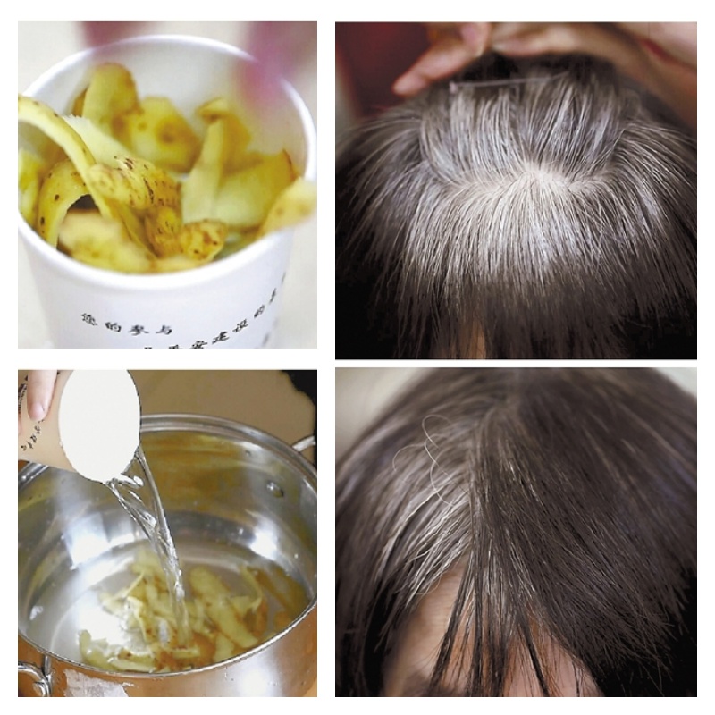 Potato Peels- The Natural Way to Defeat Gray Hair 1