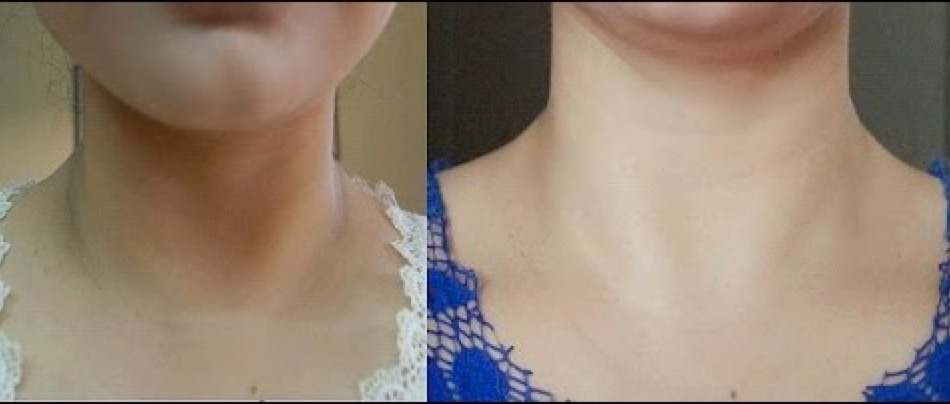 How to Get Rid Of Dark Neck and Brighten Skin Quickly